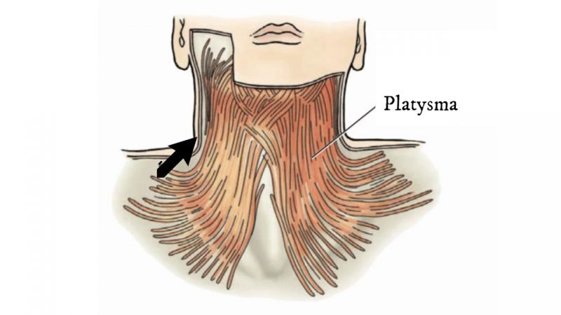 cơ platysma